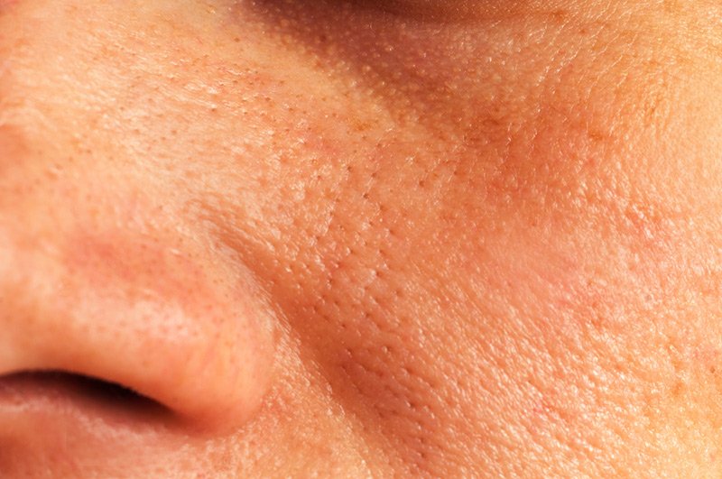 ORPW Skin Type: What You Need to Know
