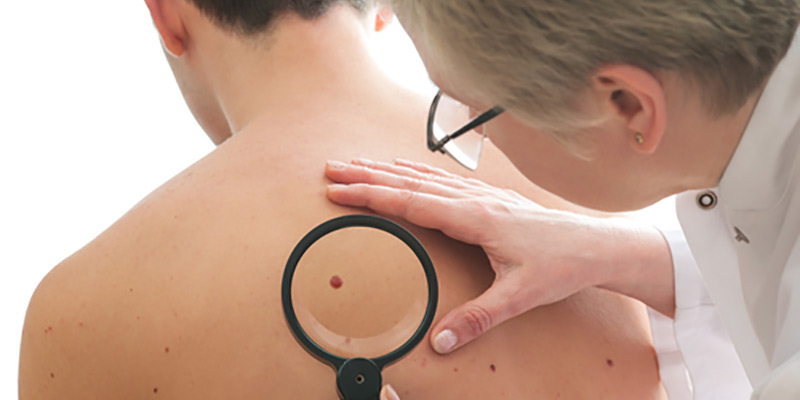 3 Different Types of Skin Cancer and Their Warning Signs