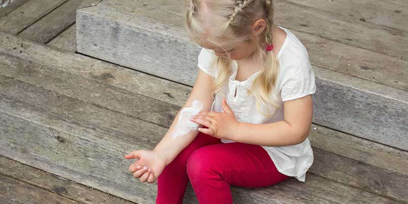 Teaching Your Child How to Manage Eczema