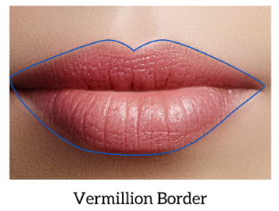 vermilion border